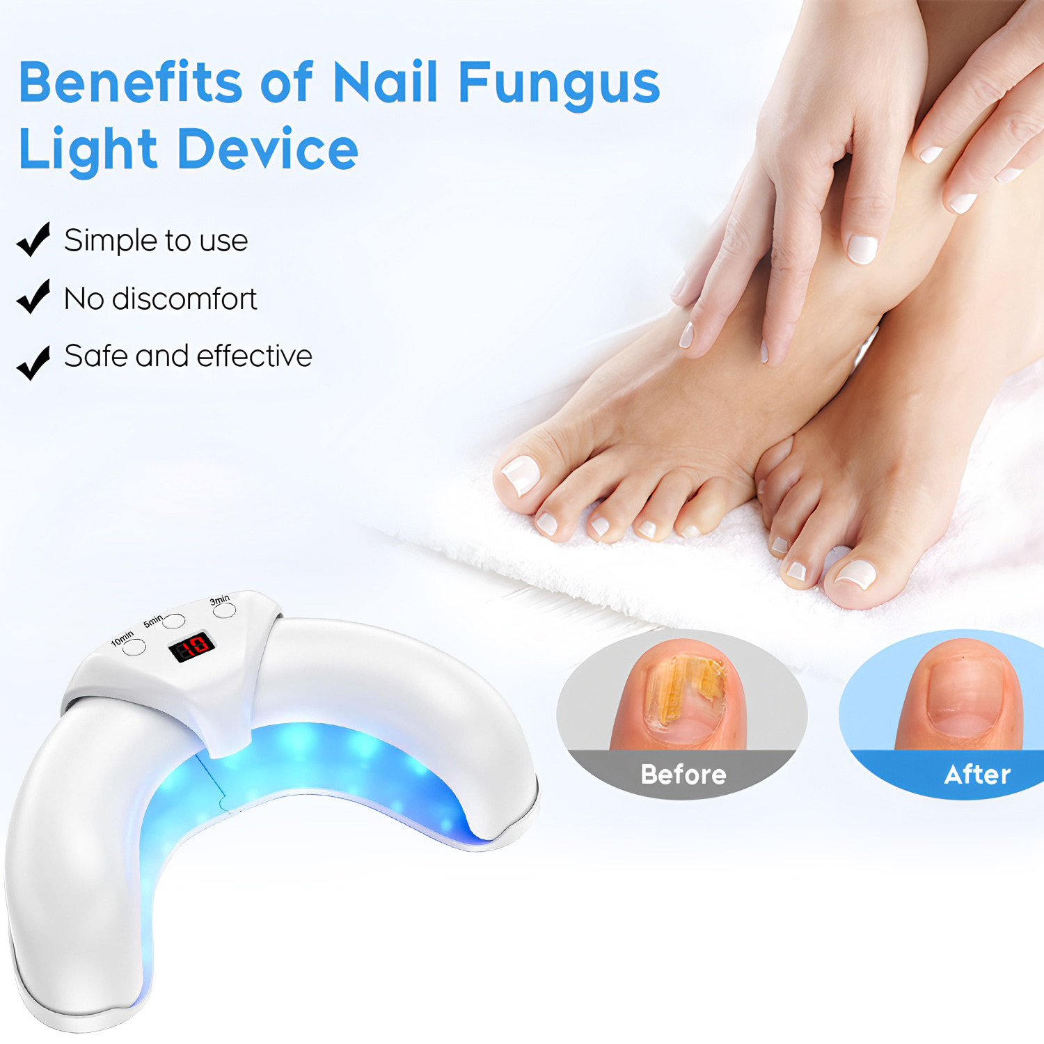 Fungus Laser Treatment Device  - Industrial Laser Removal review and price