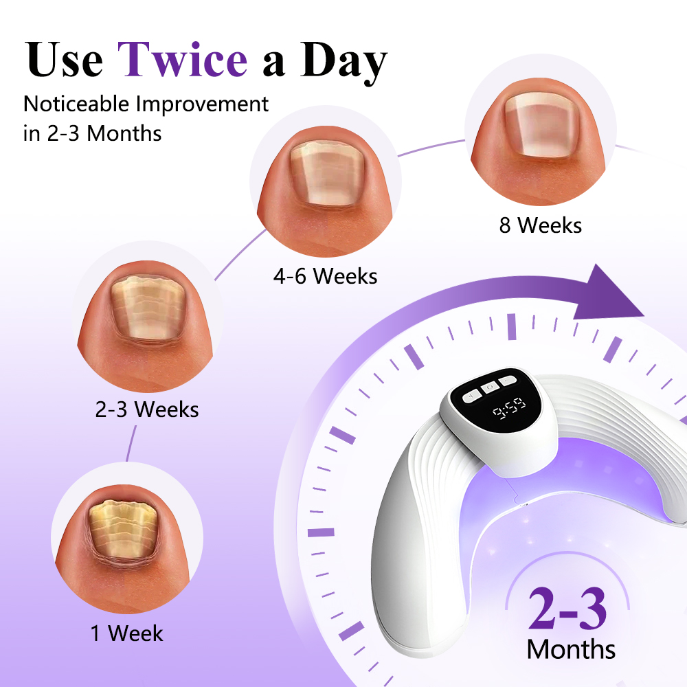 2-in-1 Nail Fungus Laser Devic - Industrial Laser Removal review and price